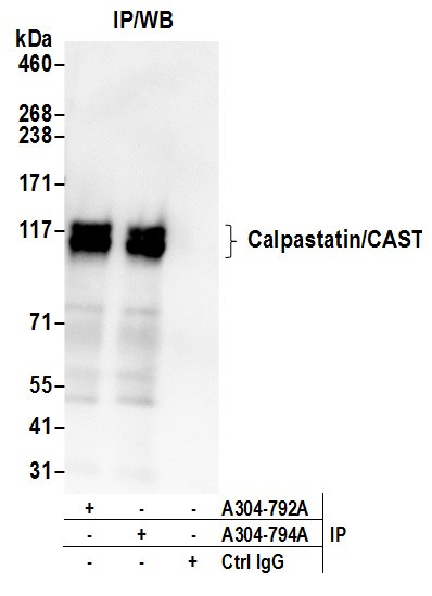 Anti-Calpastatin/CAST