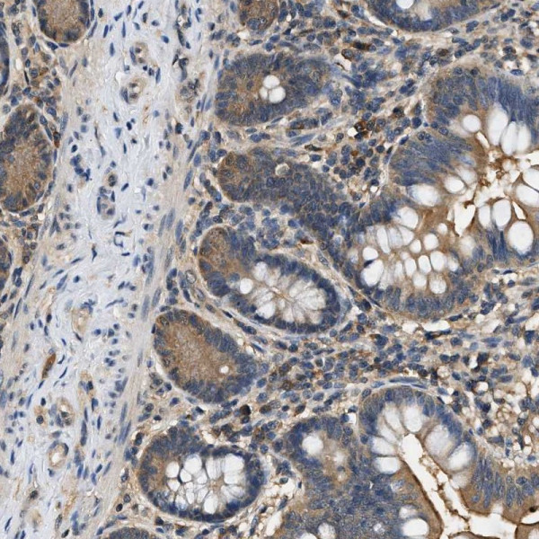 Anti-BCL7C