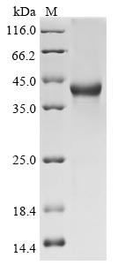 SPARC-related modular calcium-binding protein 1 (SMOC1), partial, human, recombinant