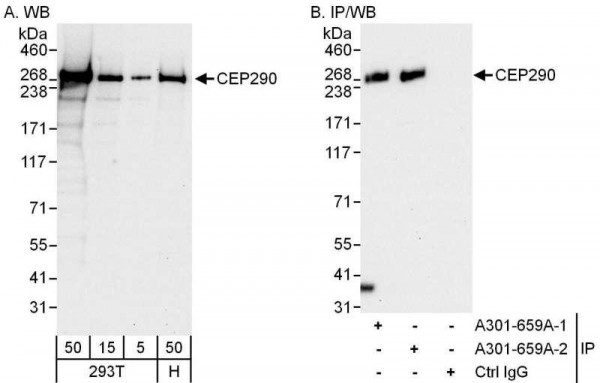 Anti-CEP290