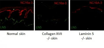 Anti-Collagen XVII, clone NC16a-3
