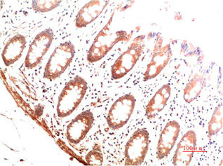 Anti-COL1A1 Monoclonal