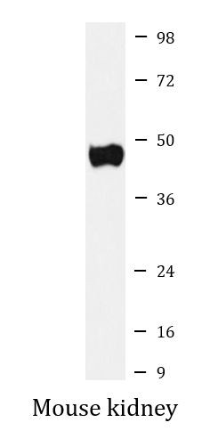 Anti-UQCRC2