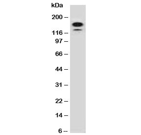 Anti-MSH6, clone MTS6-1