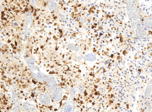 Anti-Histone H3.3 G34R Mutant (human), Rabbit Monoclonal (RM240) (Biotin)