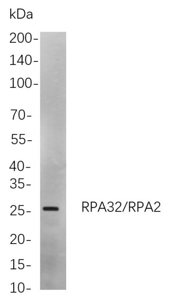 Anti-Recombinant RPA32/RPA2, clone 4F10