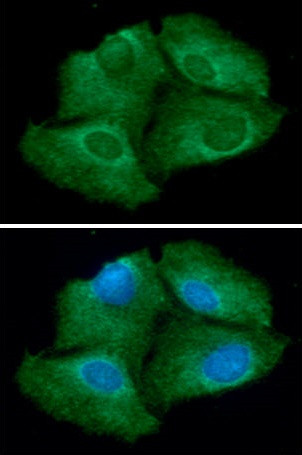 Anti-Thioredoxin Reductase 1, clone 30F1