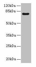 Anti-TTC30A
