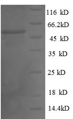 Thiopurine S-methyltransferase (TPMT), partial, human, recombinant