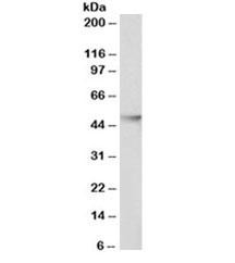 Anti-HDAC3