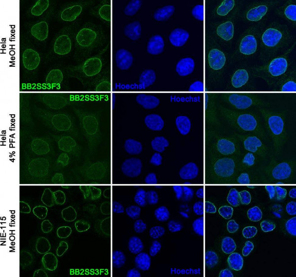 Anti-Lamin B Receptor, clone BB2SS3F3