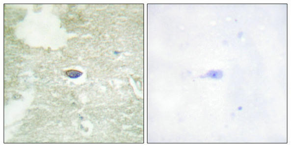Anti-phospho-TGFBR2 (Ser225/250)
