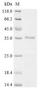 SUN domain-containing protein 1 (SUN1), partial, recombinant human