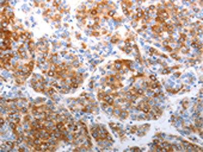 Anti-CDH5