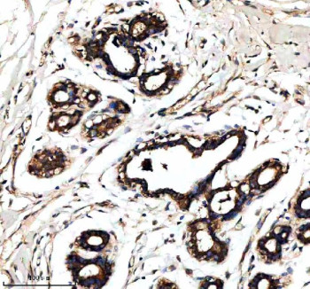 Anti-RALGAPB / Ral GTPase-activating protein subunit beta