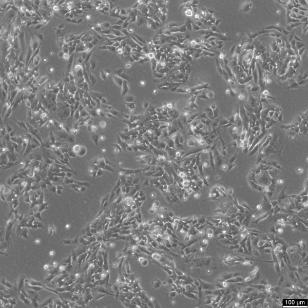 SK-N-AS Cells