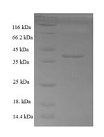 Calponin-3 (CNN3), partial, human, recombinant