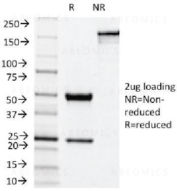 Anti-NOX4 / NADPH Oxidase 4 Monoclonal Antibody (Clone: NOX4/1245)
