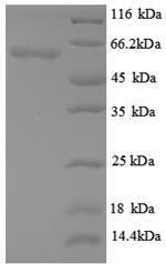 Angiopoietin-2 (Angpt2), partial, mouse, recombinant