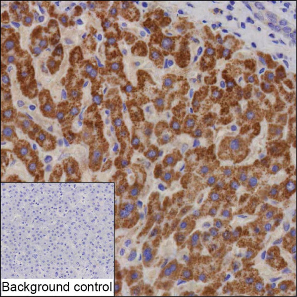 Anti-ACSM5