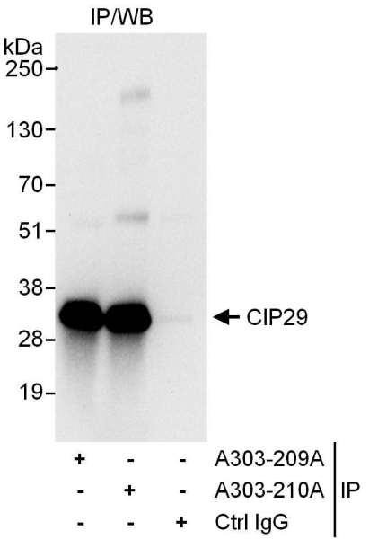 Anti-CIP29