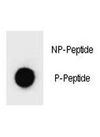 Anti-phospho-PARP1 (Ser41)