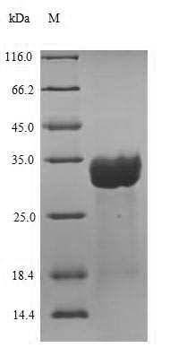 Centrin-2 (CETN2), human, recombinant