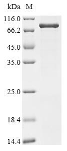 Junctional protein associated with coronary artery disease (JCAD), partial, human, recombinant