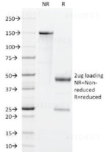 Anti-GM-CSF (Granulocyte/Macrophage - Colony Stimulating Factor) Monoclonal Antibody (Clone: BVD2-21