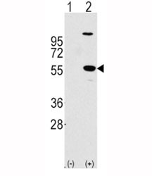Anti-ALDH1A1