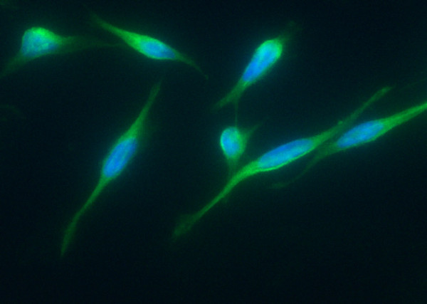 Anti-ITCH/AIP4 Monoclonal Antibody