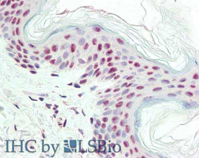 Anti-IPO-38, clone IPO-38