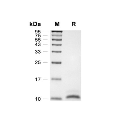 Parathyroid Hormone (PTH) Recombinant (Human)