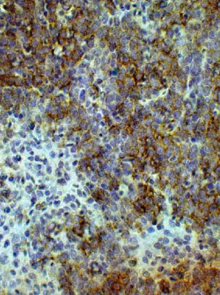 Anti-CD8a, clone CT-8