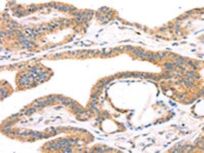Anti-TPH2