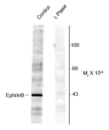 Anti-phospho-EphrinB (Tyr298)
