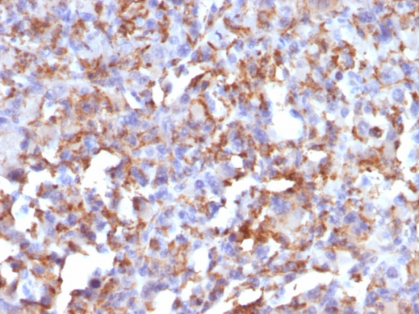 Anti-CD68 (Macrophage Marker), clone LAMP4/824