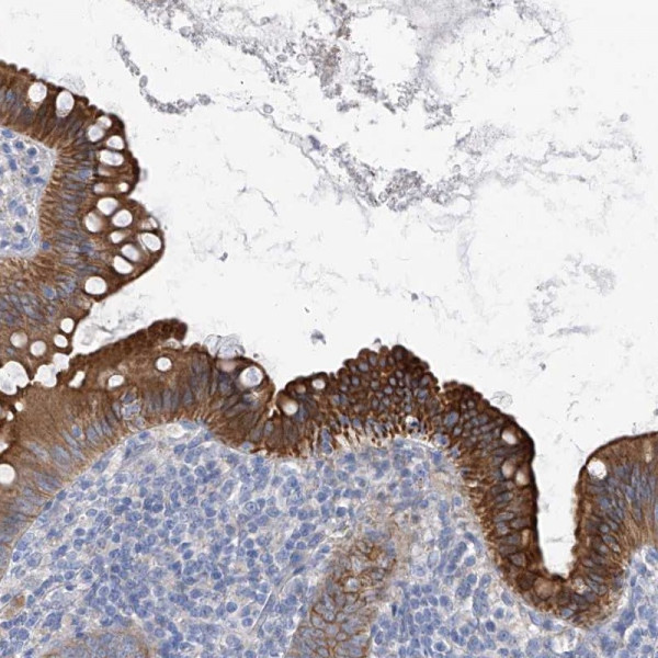 Anti-PIK3C2B