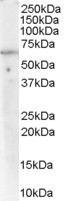 Anti-PP2A / PPP2R1A, C-terminal