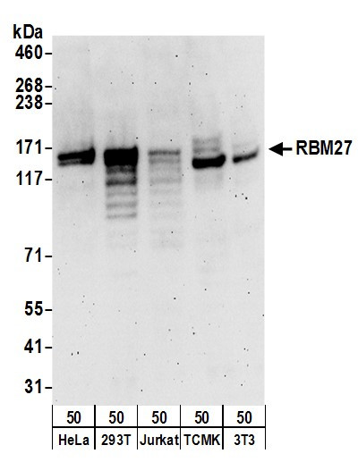 Anti-RBM27