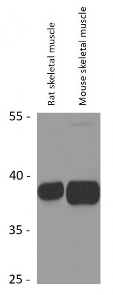Anti-HOXA13