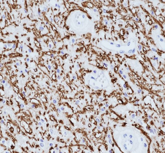 Anti-Myelin Basic Protein, clone SQab19166