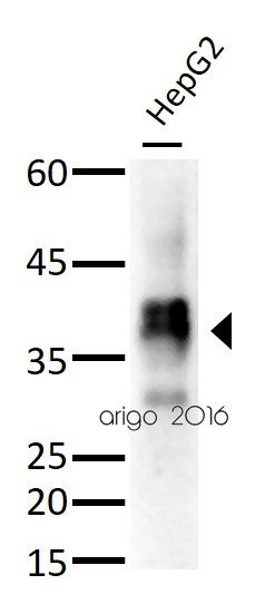 Anti-Haptoglobin