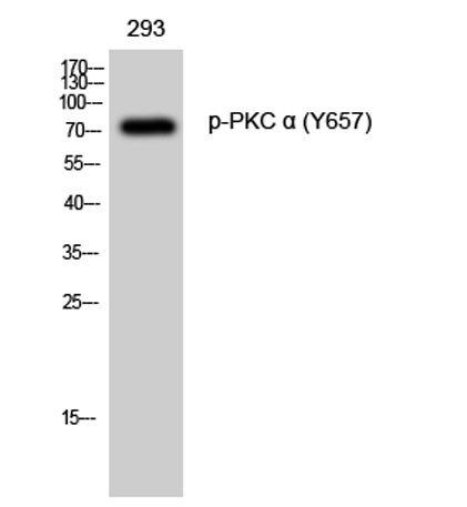Anti-phospho-PKC alpha (Tyr658)