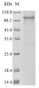 Alpha-1,3-mannosyl-glycoprotein 4-beta-N-acetylglucosaminyltransferase A (MGAT4A), partial, human, r
