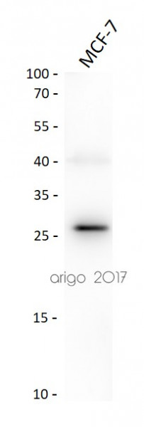 Anti-Bcl-2, clone 124