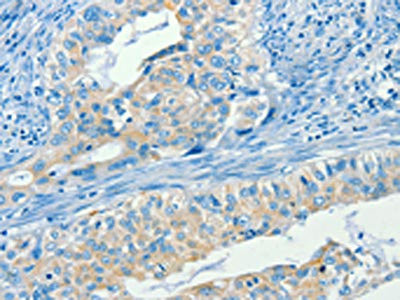 Anti-SERPINA9