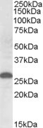 Anti-Apolipoprotein M, Internal