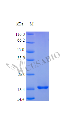 Fibroblast growth factor 4 protein (FGF4), partial (Active), human, recombinant