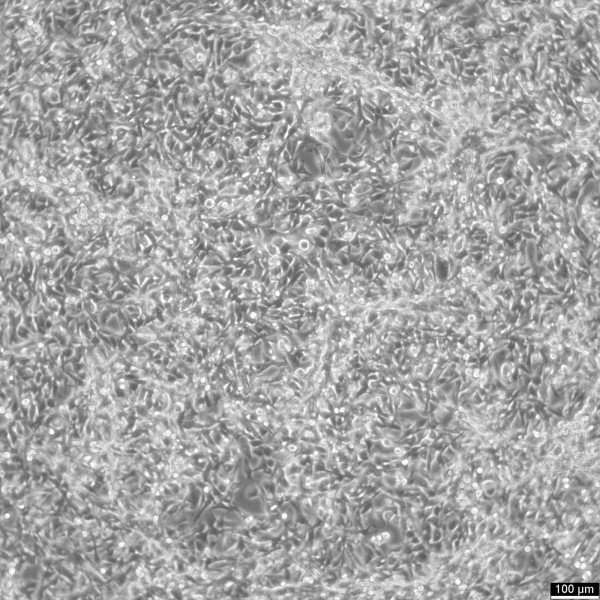 PIEC Cells